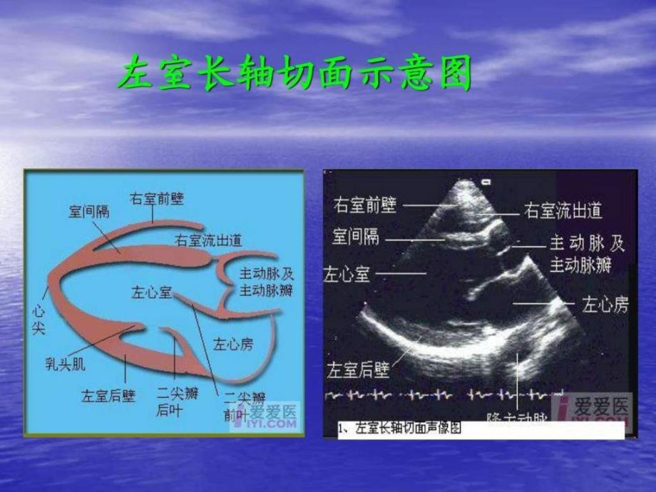 心脏超声切面示意_第3页