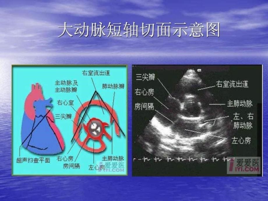 心脏超声切面示意_第5页