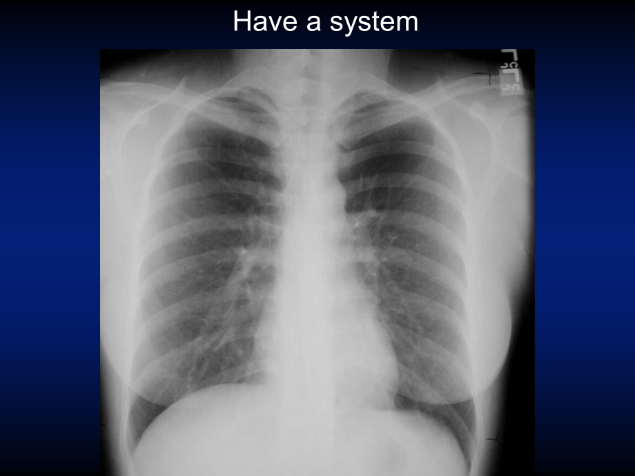 医学ppt--basicchestxraymodadam_第3页