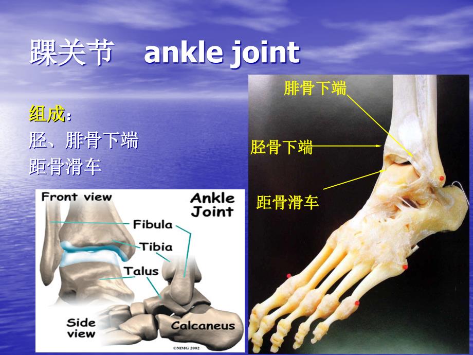 全踝关节置换术ppt课件_第2页