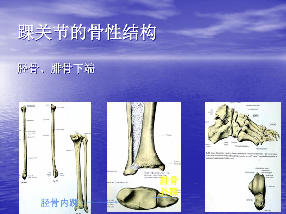 全踝关节置换术ppt课件_第3页