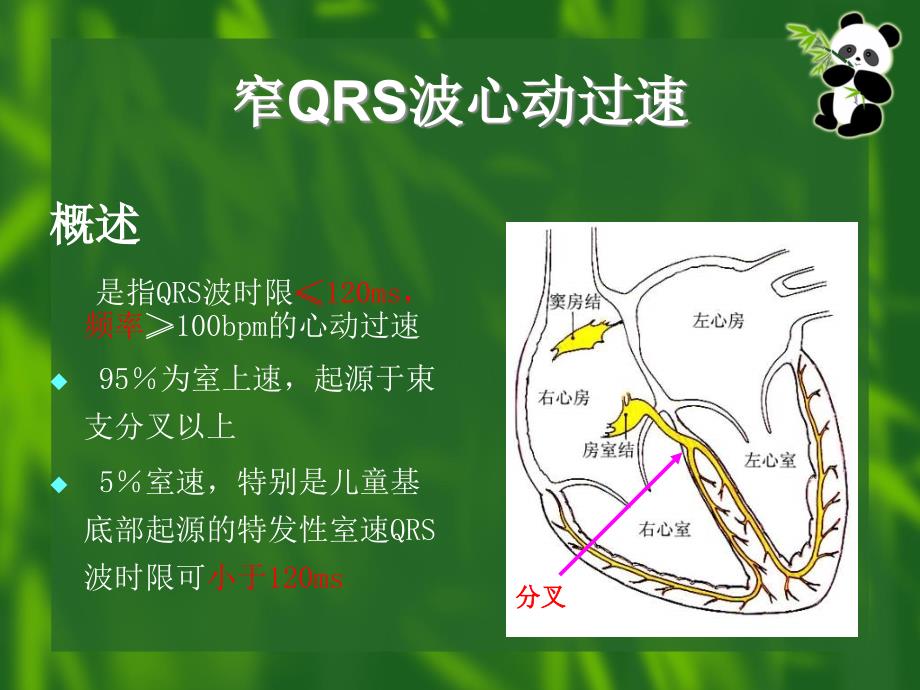 窄qrs波心动过速的诊断与鉴别诊断ppt课件_第4页