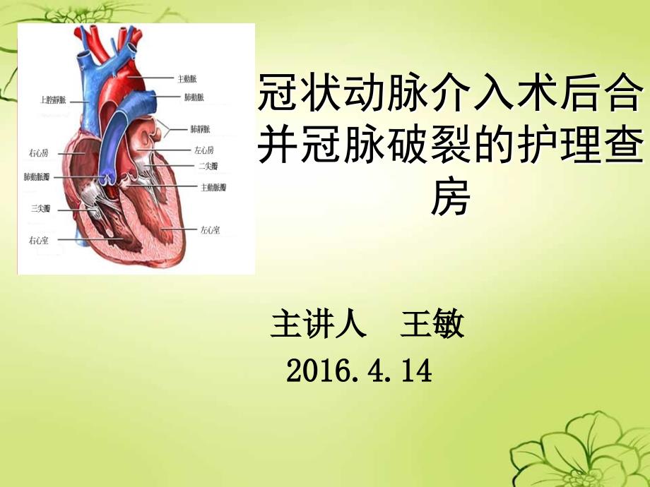 冠状动脉介入治疗的护理查房ppt课件_第1页