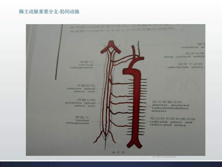 《主动脉疾病》ppt课件_第3页