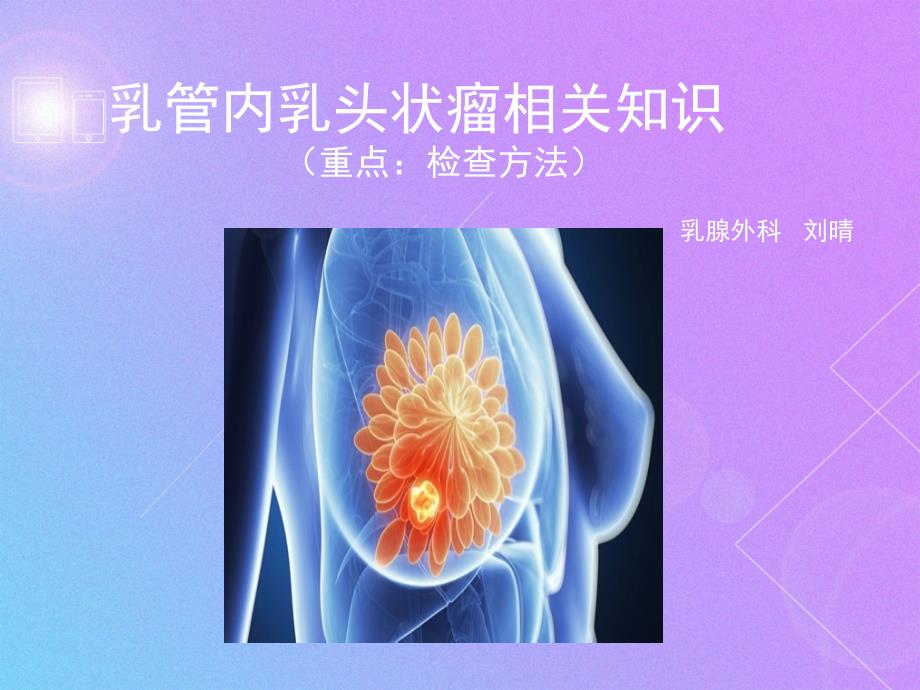 乳管内乳头状瘤相关知识ppt课件_第1页