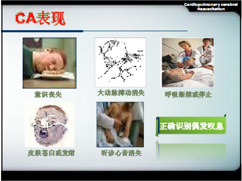 心肺复苏(cpr)相关抢救监测技术ppt课件_第4页