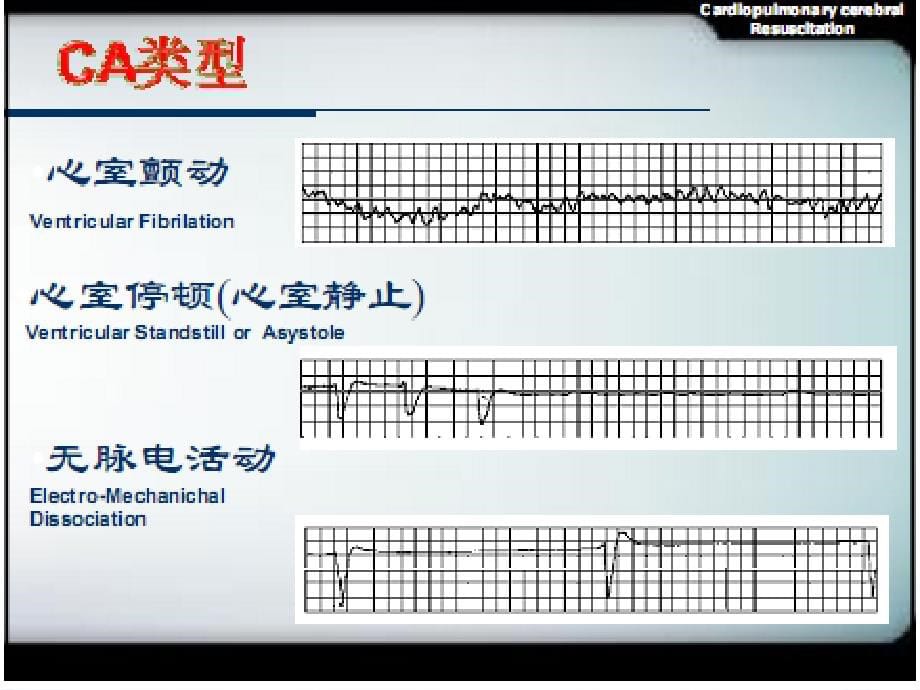 心肺复苏(cpr)相关抢救监测技术ppt课件_第5页