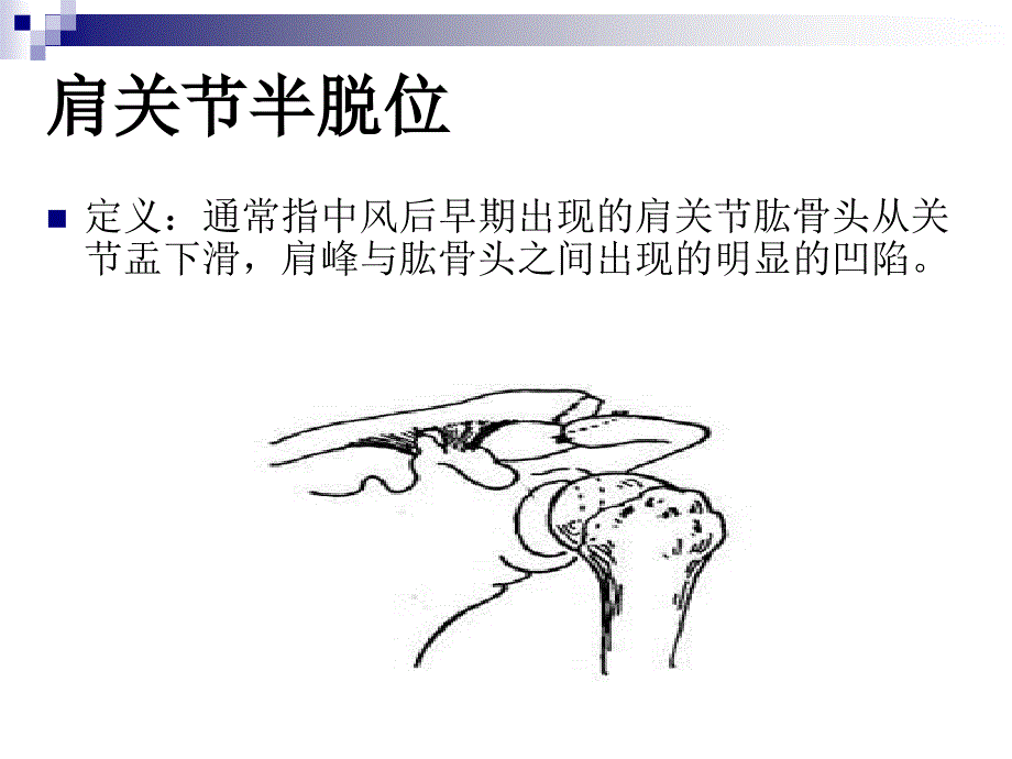 偏瘫患者肩关节常见问题ppt课件_第2页