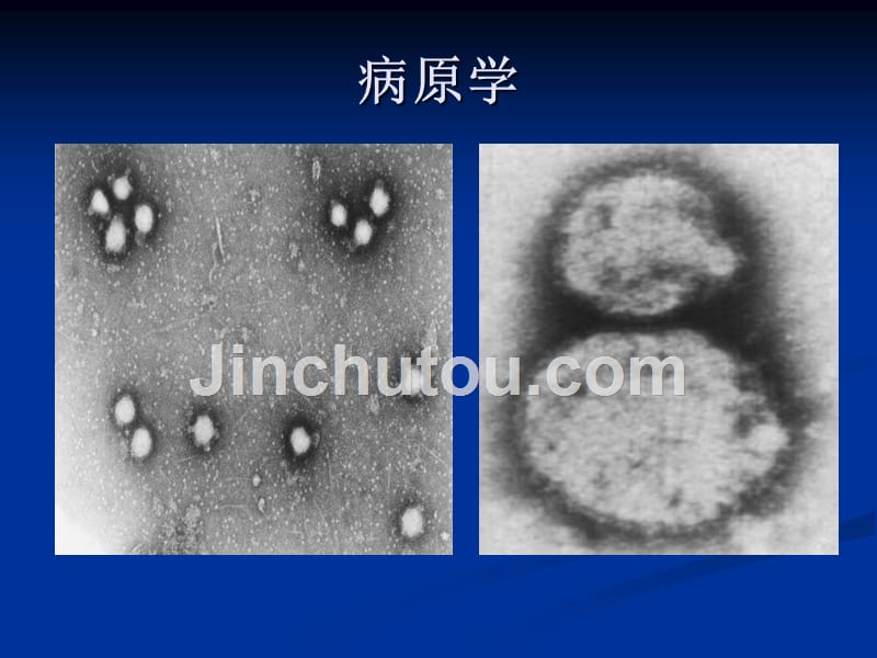 感染病学（上海交通大学）肾综合征出血热_第5页