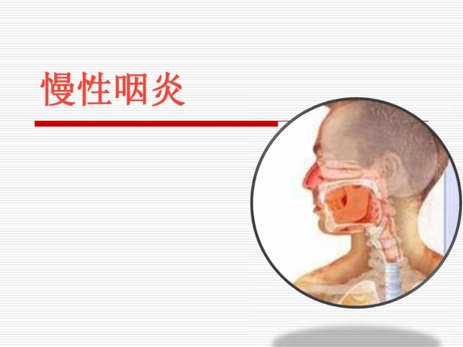 《慢性咽炎07》ppt课件_第1页