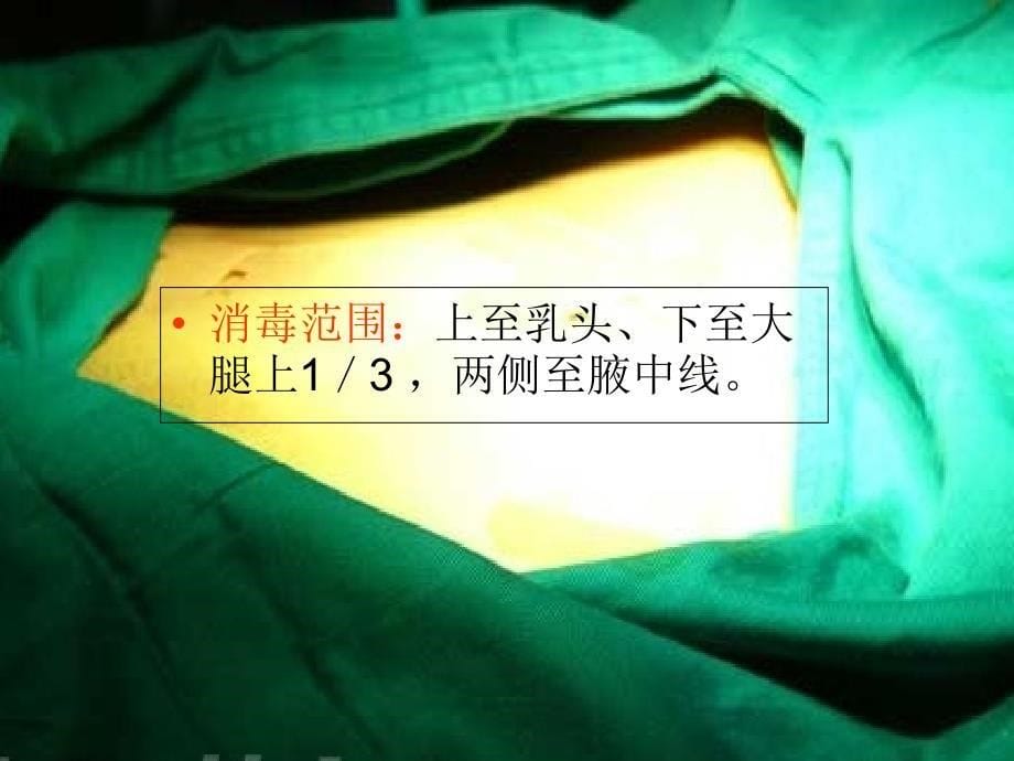 腹腔镜下子宫肌瘤剥除术护理人员的手术配合2ppt课件_第5页