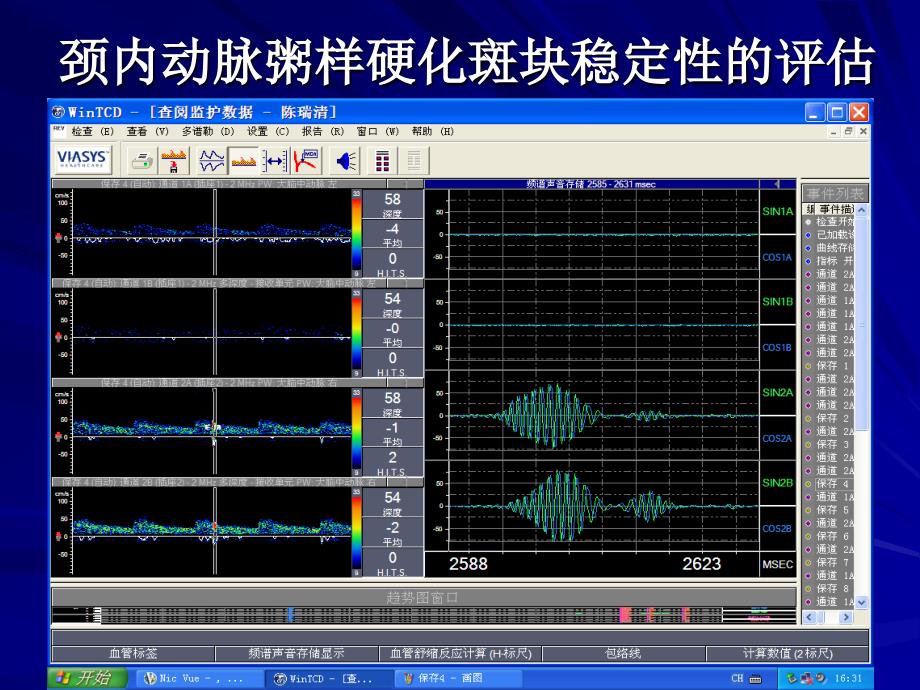 脑梗塞合并高脂血二级预防_第3页