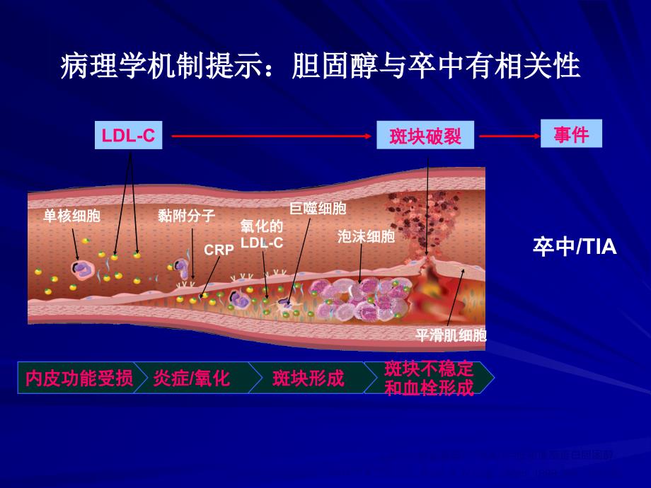 脑梗塞合并高脂血二级预防_第4页