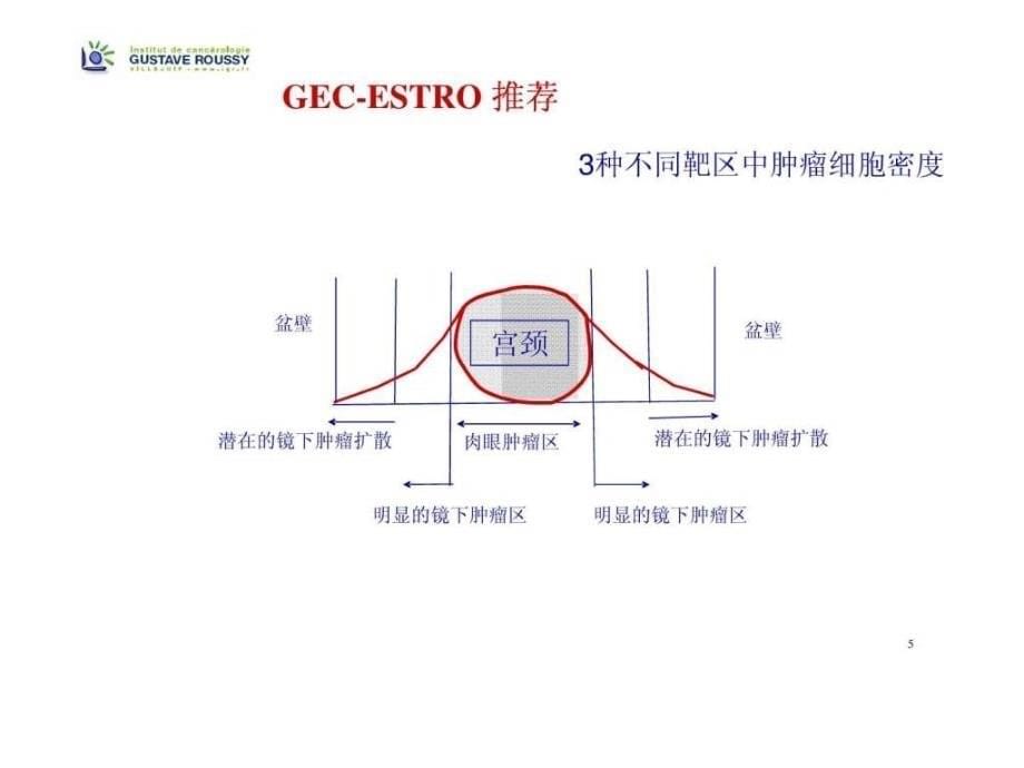 宫颈癌近距离放疗中靶区及危及器官勾画-gecestro推荐_第5页