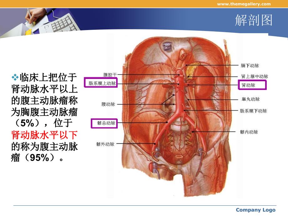 腹主动脉瘤的护理ppt_第4页