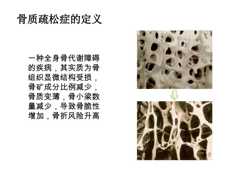 《骨标志物》ppt课件_第2页