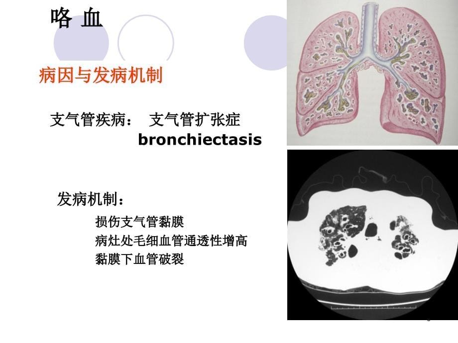 《问诊咯血》ppt课件_第5页