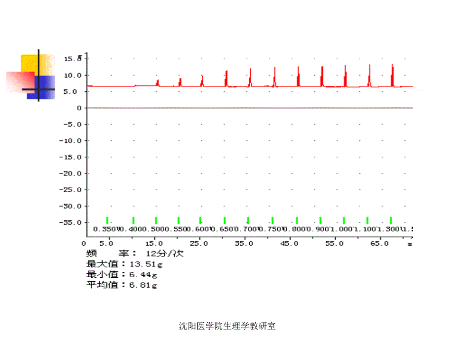 刺激强度、频率对蟾蜍骨骼肌收缩的影响_第3页