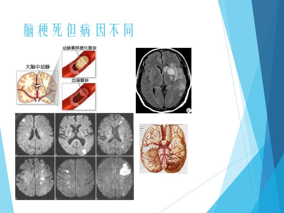 《toast分型》ppt课件_第4页