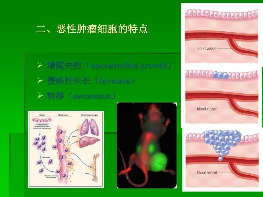 课件：抗恶性肿瘤_第5页