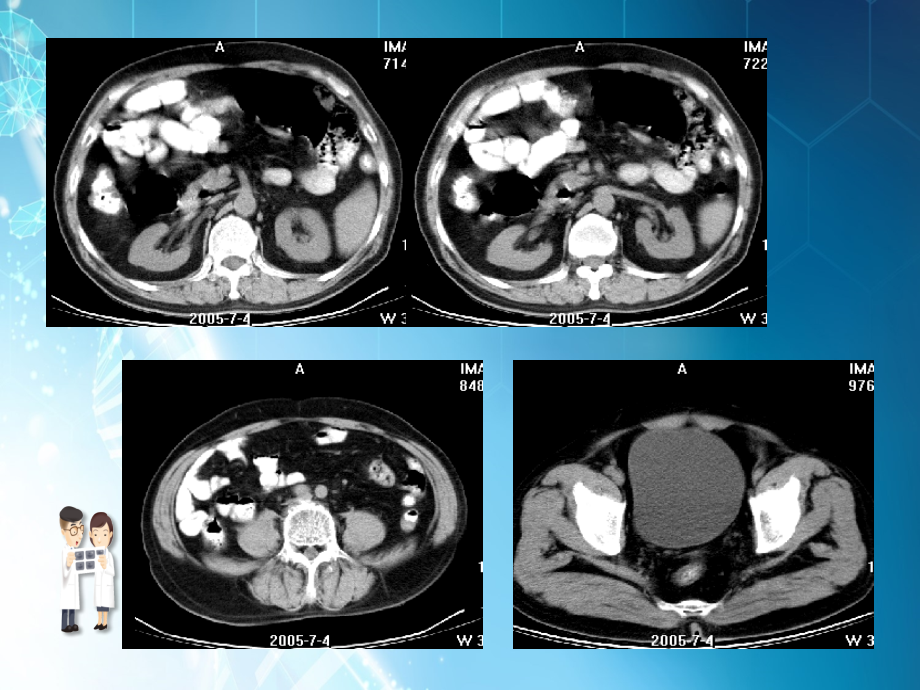 课件：泌尿系统ct检查_第3页