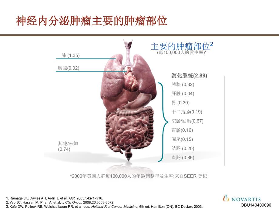 课件：神经内分泌肿瘤研究进展_第4页