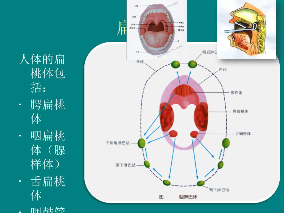 课件：扁桃体切除对iga肾病的影响_第4页