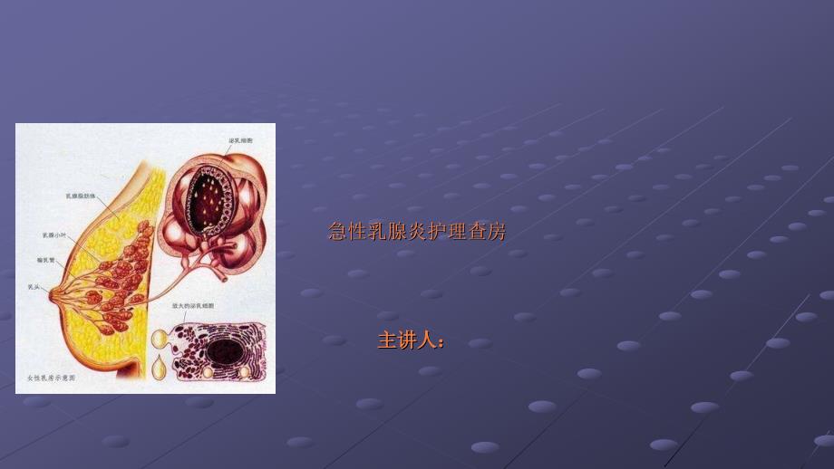 课件：急性乳腺炎护理查房_第1页