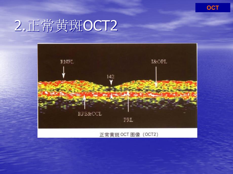 课件：oct结果解读_第4页