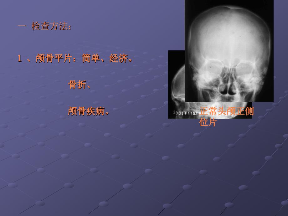 课件：颅脑影像学检查_第4页