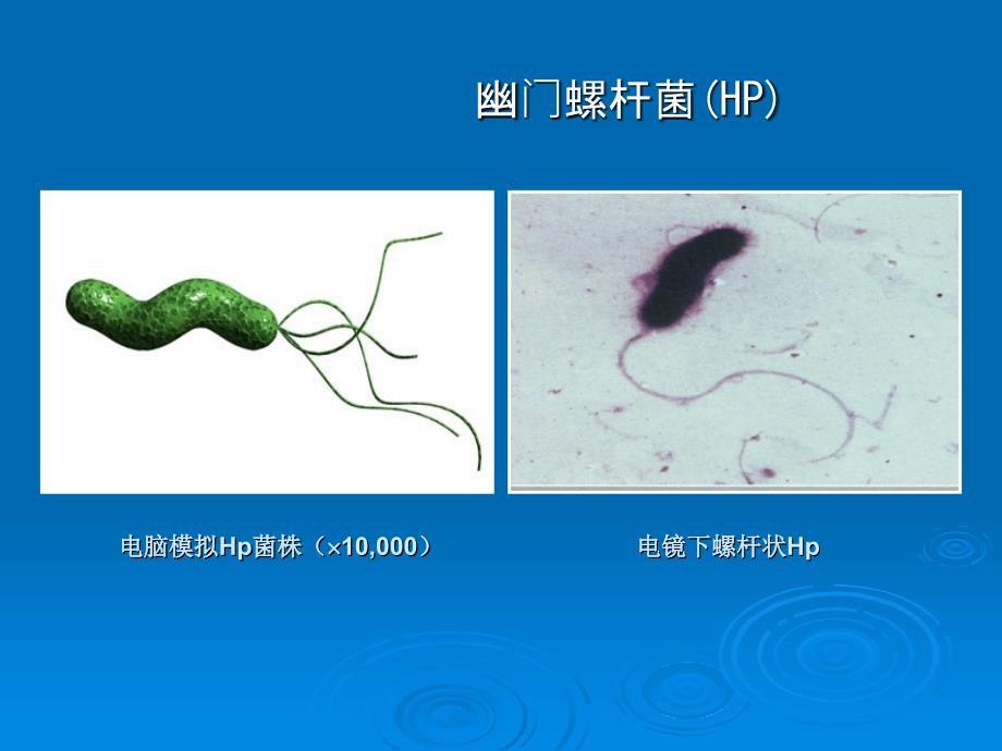 课件：hp的治疗课件_第4页