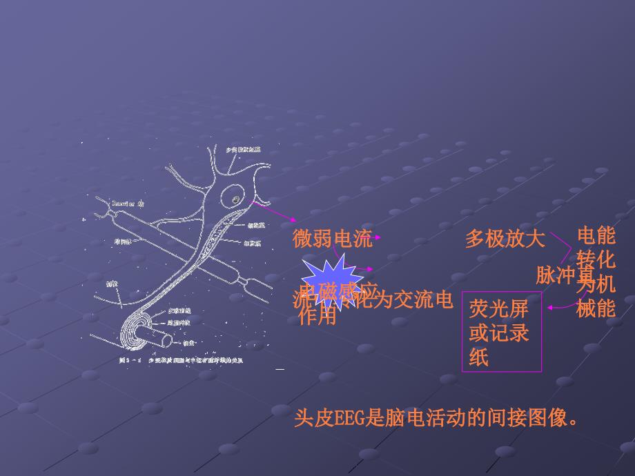 课件：脑电图基本知识及判读_第4页