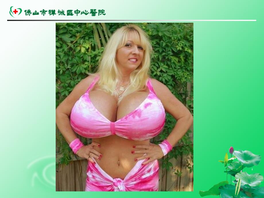 课件：乳腺癌的防治_第2页