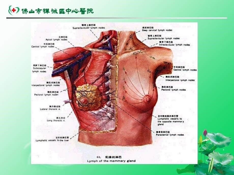 课件：乳腺癌的防治_第5页