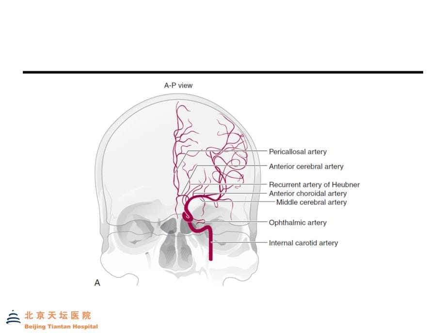 课件：脑血管定位诊断_第5页