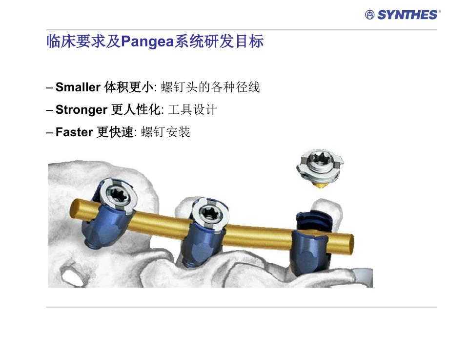 angea上开口多轴向椎弓根螺钉产品介绍_第4页