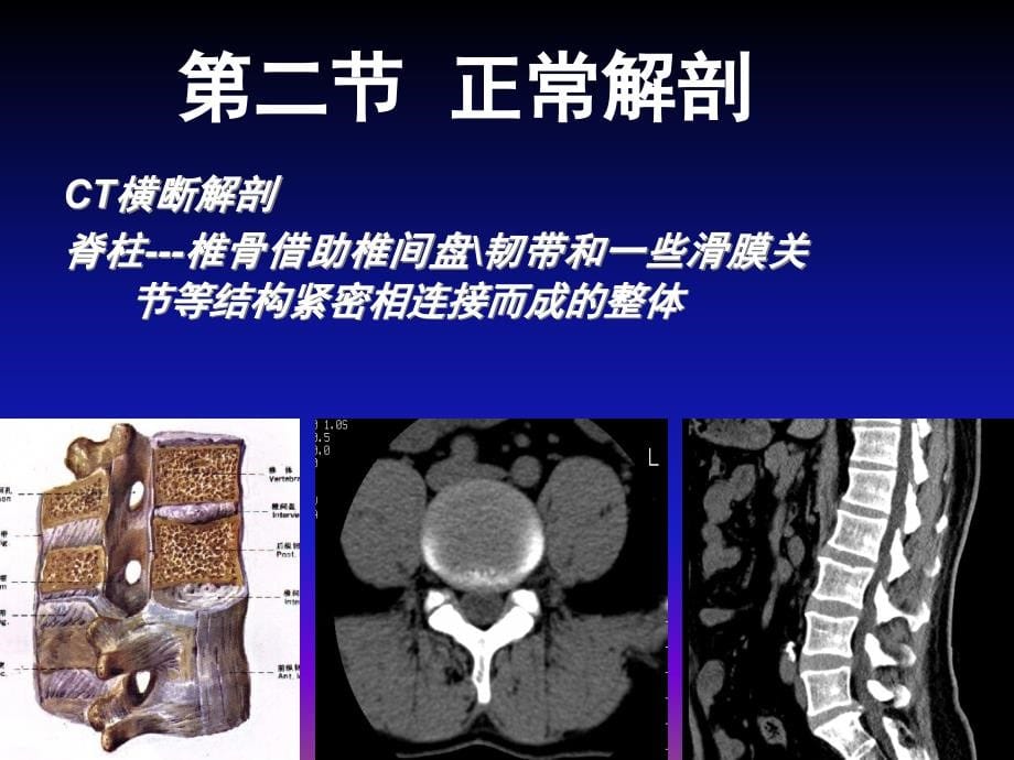 课件：骨与关节ct诊断1_第5页