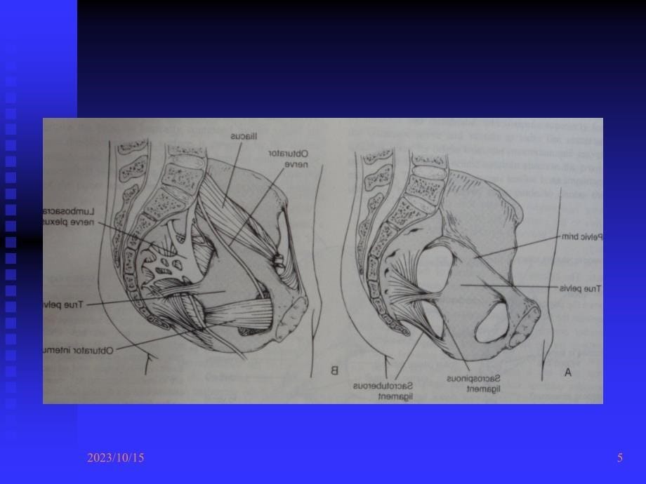 课件：骨盆的临床解剖_第5页
