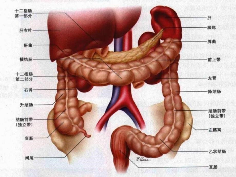 课件：结肠癌课件_第5页