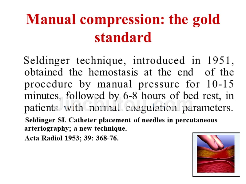 vascularcloserdevice-meetcongress：血管闭合装置满足国会_第2页