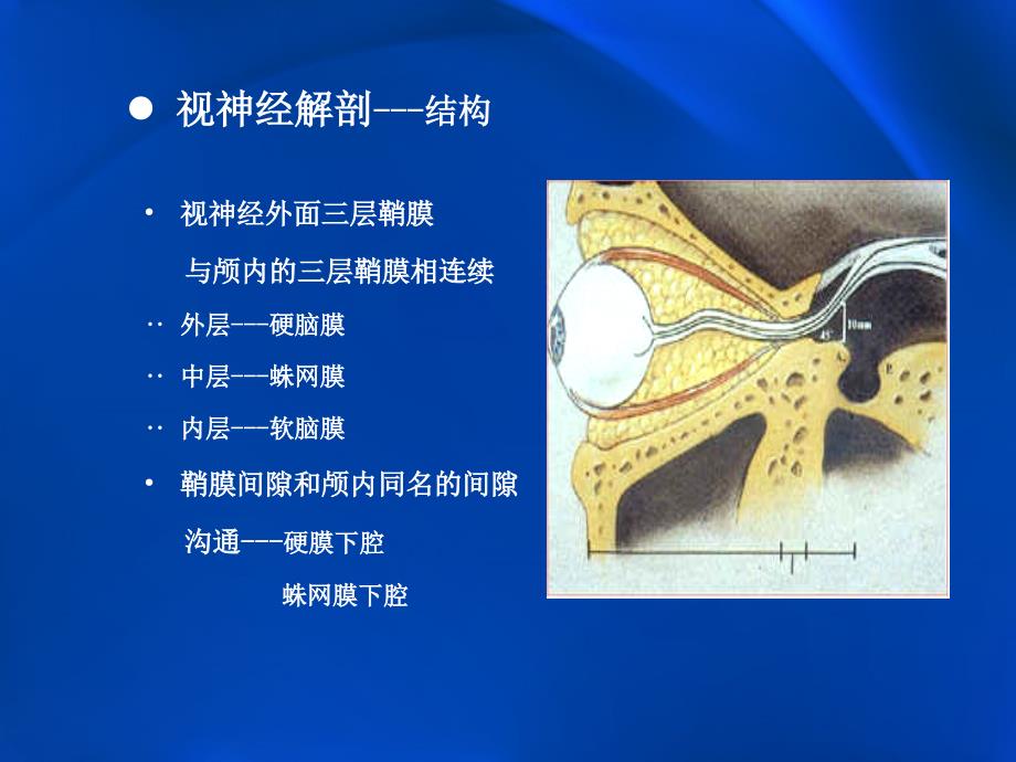 课件：视神经肿瘤影像学表现及鉴别_第4页