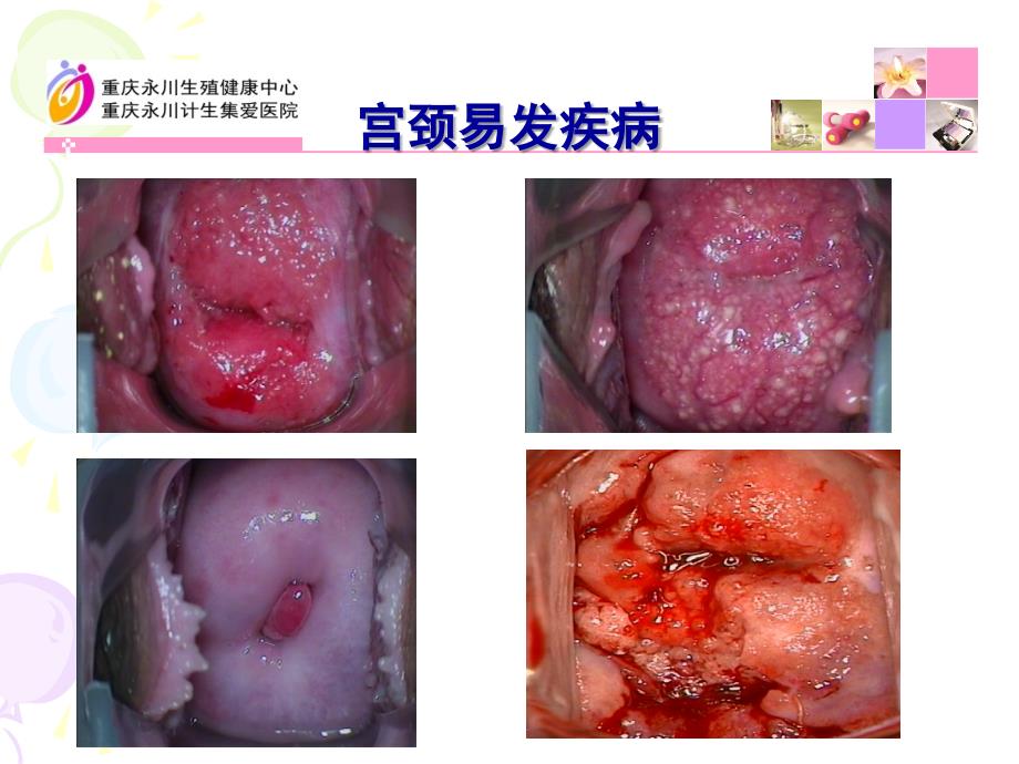 《健康宫颈》ppt课件_第4页