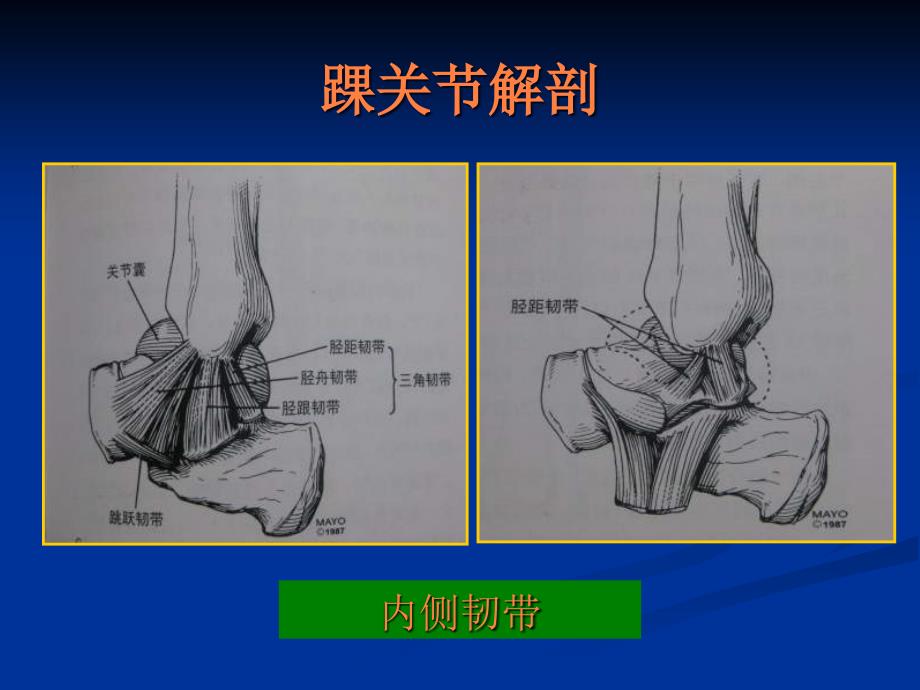 课件：踝关节影像诊断_第4页