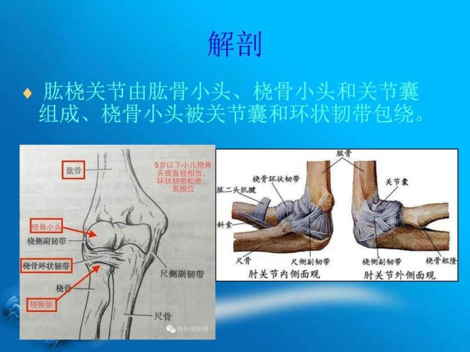 课件：桡骨小头半脱位_第3页