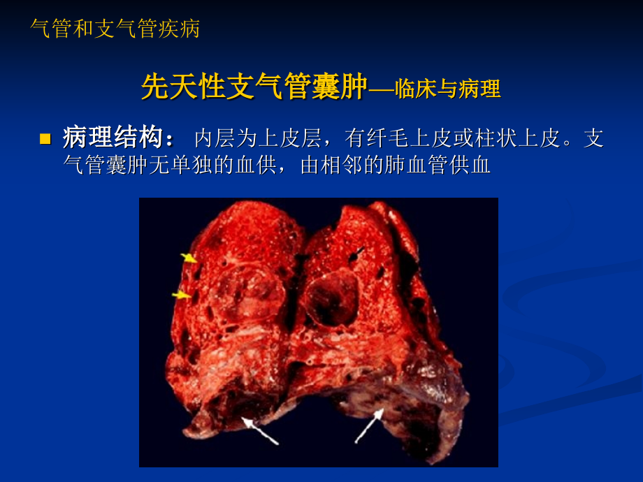 《气管和支气管疾病》ppt课件_第4页