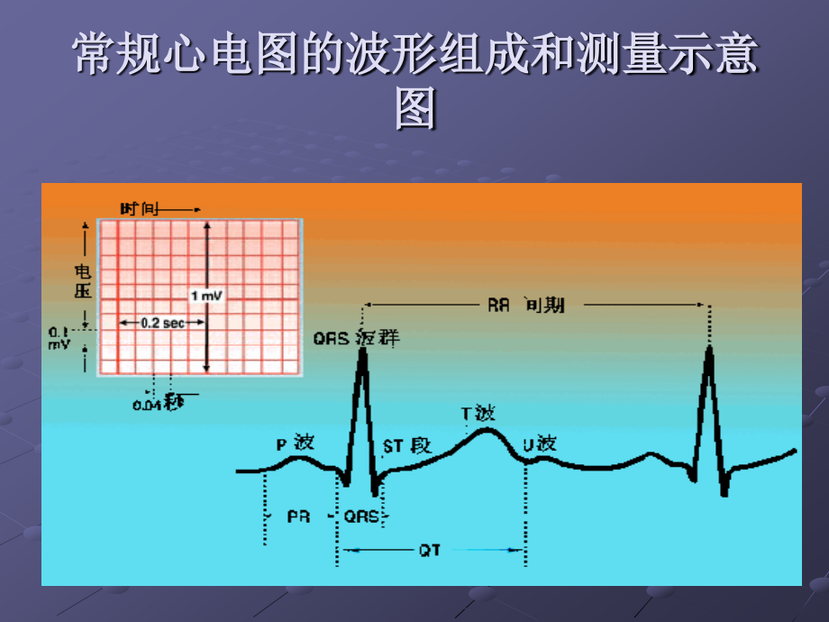 张蜀-急诊心律失常的诊断与处理_第4页