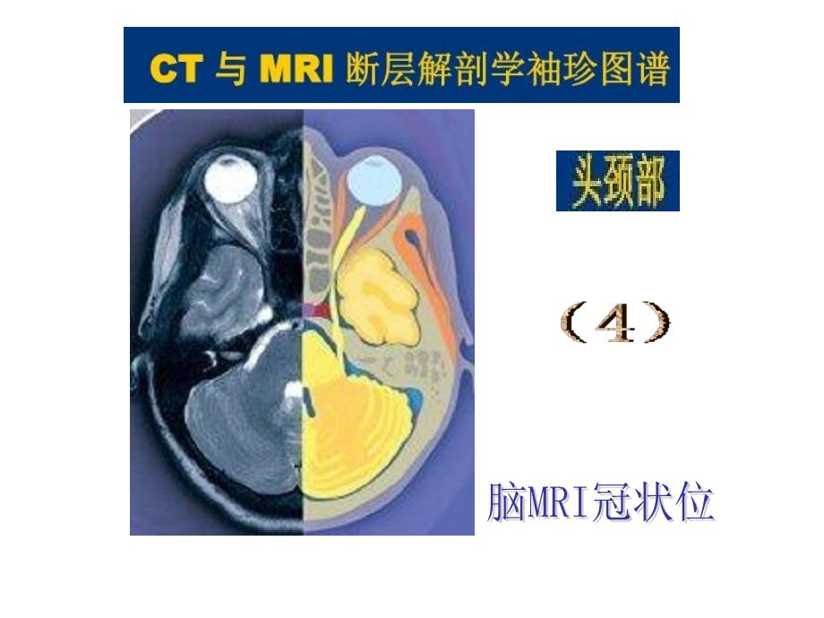 头颈ct-mri解剖图解第四季_第1页