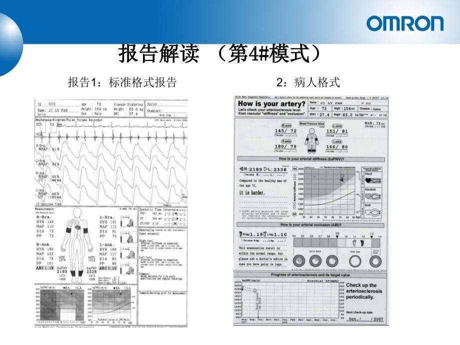 动脉硬化报告解读手册康华_第2页