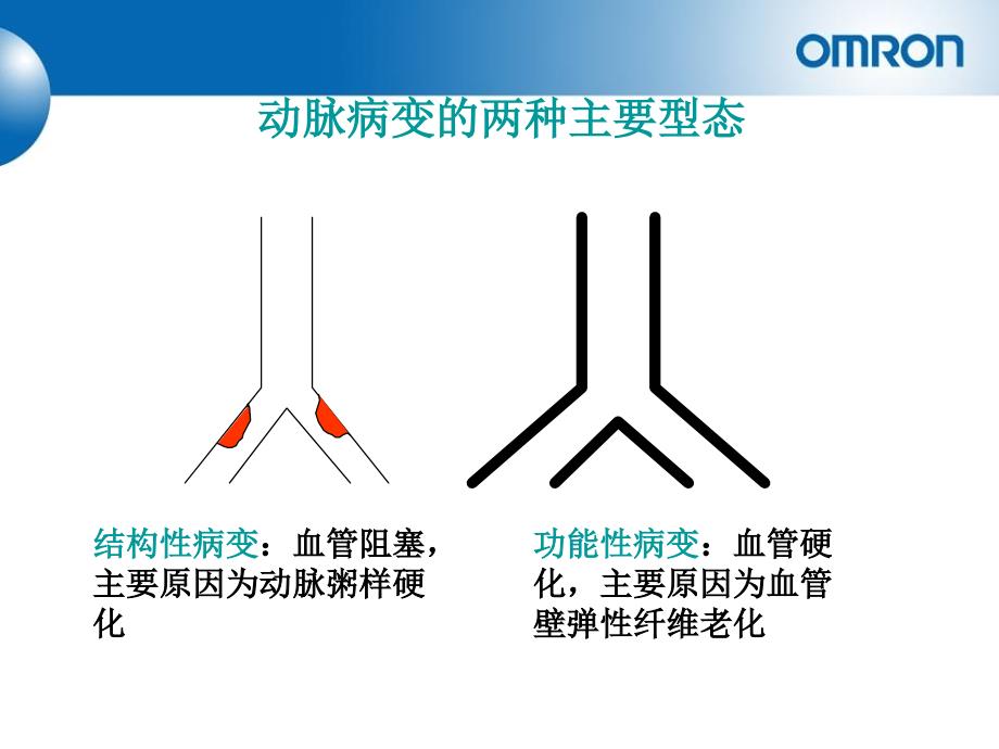 动脉硬化报告解读手册康华_第3页