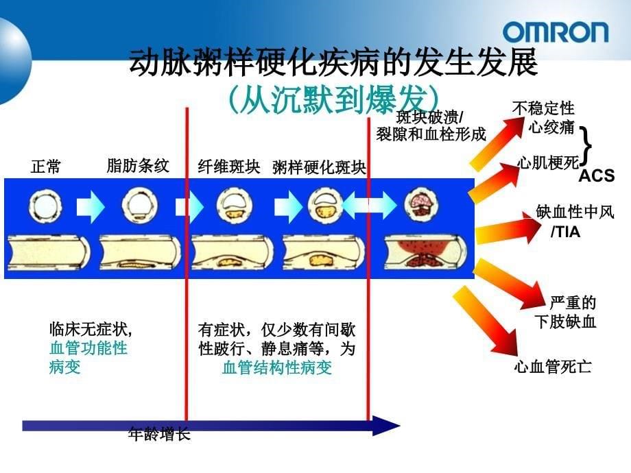 动脉硬化报告解读手册康华_第5页